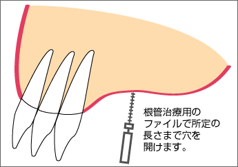 �h�����Ȃ��EOAM�菇