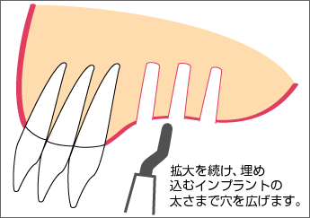�g��𑱂������L���܂��B